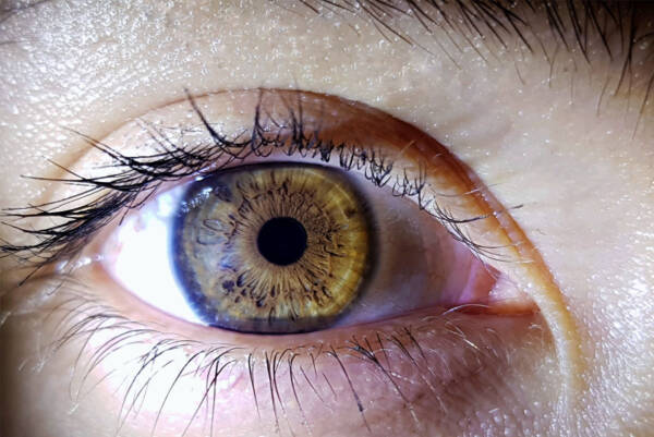 Colour Vision Report - Gildeas Opticians